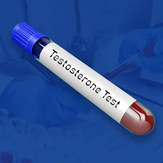 Testosterone, Free And Sex Hormone Binding Test